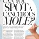 Woman & Home Spot a Cancerous Mole
